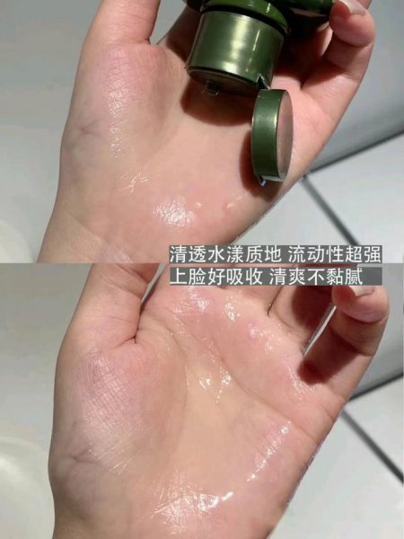 油皮用什么护肤品比较好