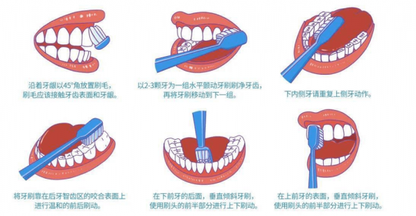 电动牙刷怎么刷牙才是正确的