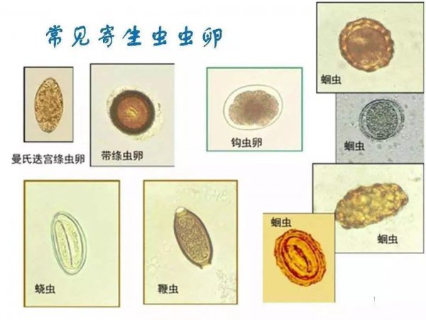 蛔虫为什么现在没有了