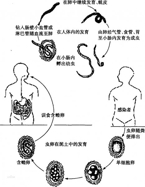 蛔虫为什么现在没有了