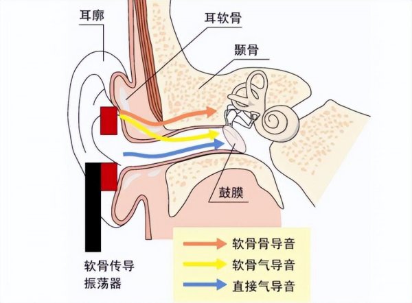 骨感耳机原理及使用方法