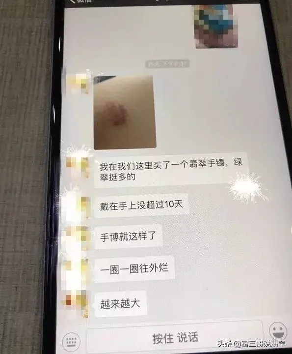 b货翡翠手镯对人体有害吗