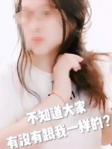 三个月不洗头的后果如何？女子怕头秃3个月不洗头的经典案例