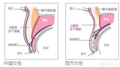 肿眼泡割双眼皮自然好看吗？