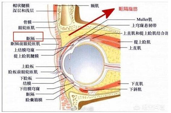 肿眼泡割双眼皮自然好看吗？