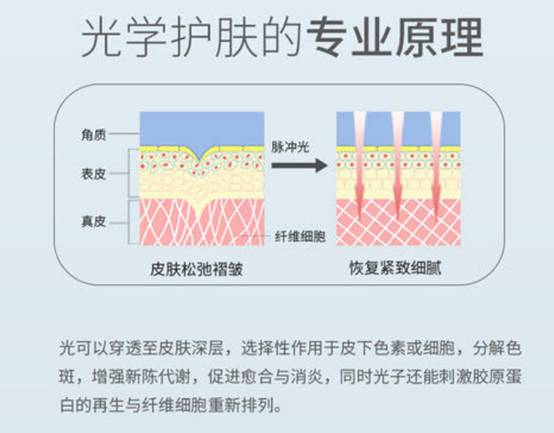 做了光子嫩肤几天见效