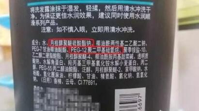 头发很干燥是什么原因怎么办？