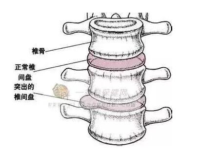 做力量训练可以减肥吗？