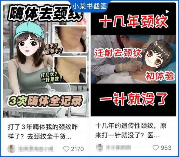 如何才能去除颈纹