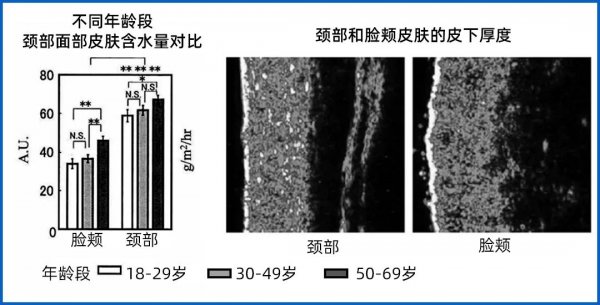 如何才能去除颈纹