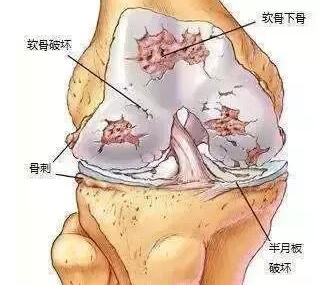 每天坚持跑步可以减肥吗？