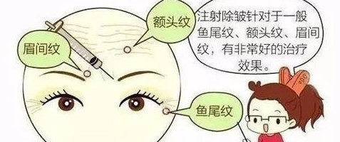 去皱针对皮肤有伤害吗