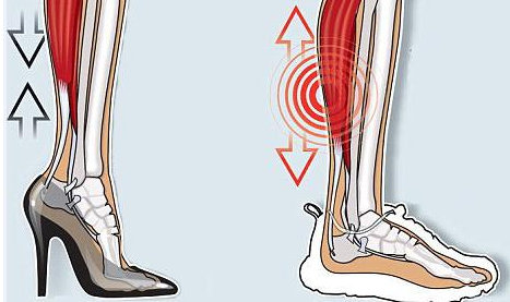 穿高跟鞋小腿会变细吗