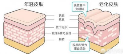 眼睛有皱纹怎么办用什么方法 眼睛有皱纹该怎么办消除的方法？