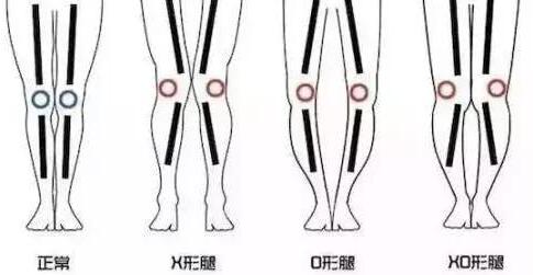 如何根据腿型挑选合适的牛仔裤？