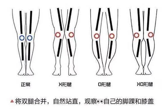 女生怎么瘦腿最有效的方法