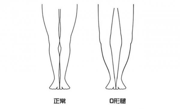 什么腿型不适合短裙？