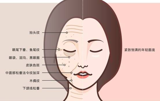 美容面部提升几种方法